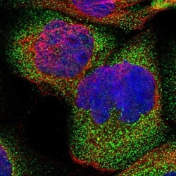 CROT Antibody, Novus Biologicals 0.1mL; Unlabeled:Antibodies, Polyclonal